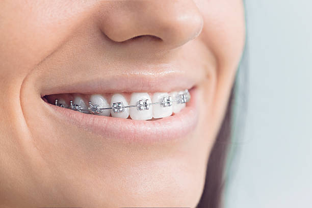 Best Dental Fillings (Composite and Amalgam)  in Olga, FL